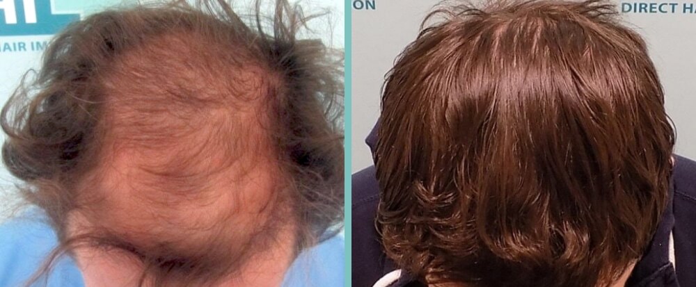 Vorher Nachher – Ludwig Z.