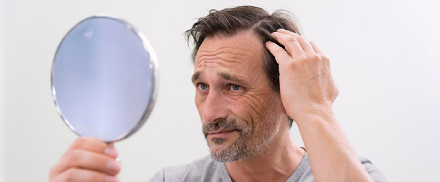 mann-spiegel-haarverlust Bild zeigt Mann mit Spiegel
