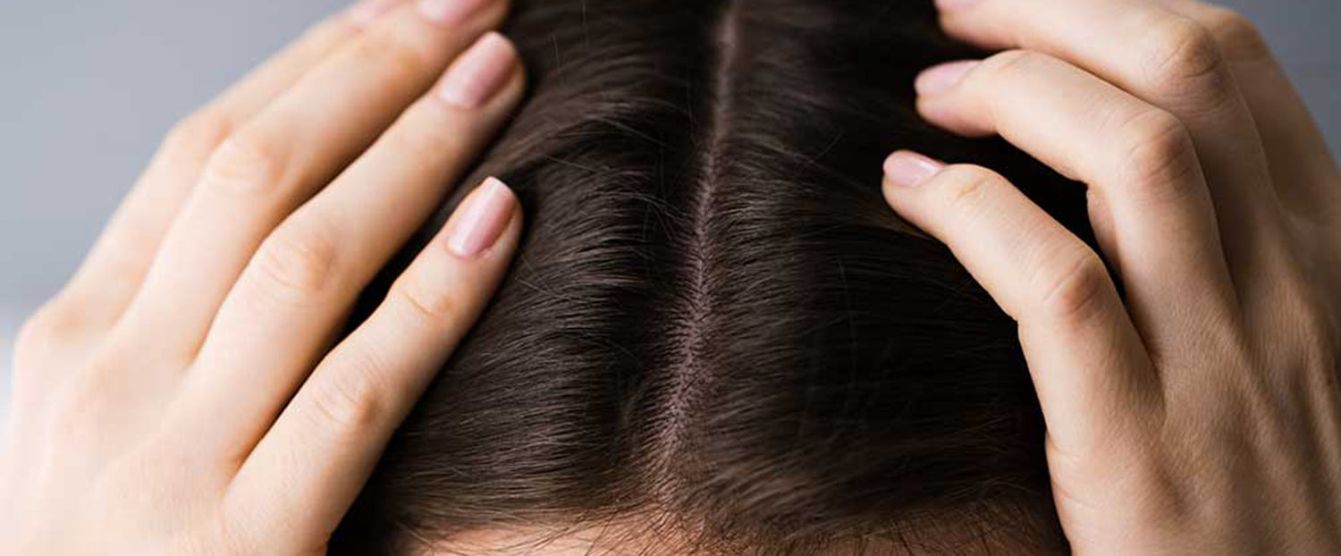 aesthetische-haarverdichtung Bild zeigt ästhetische Haarverdichtung