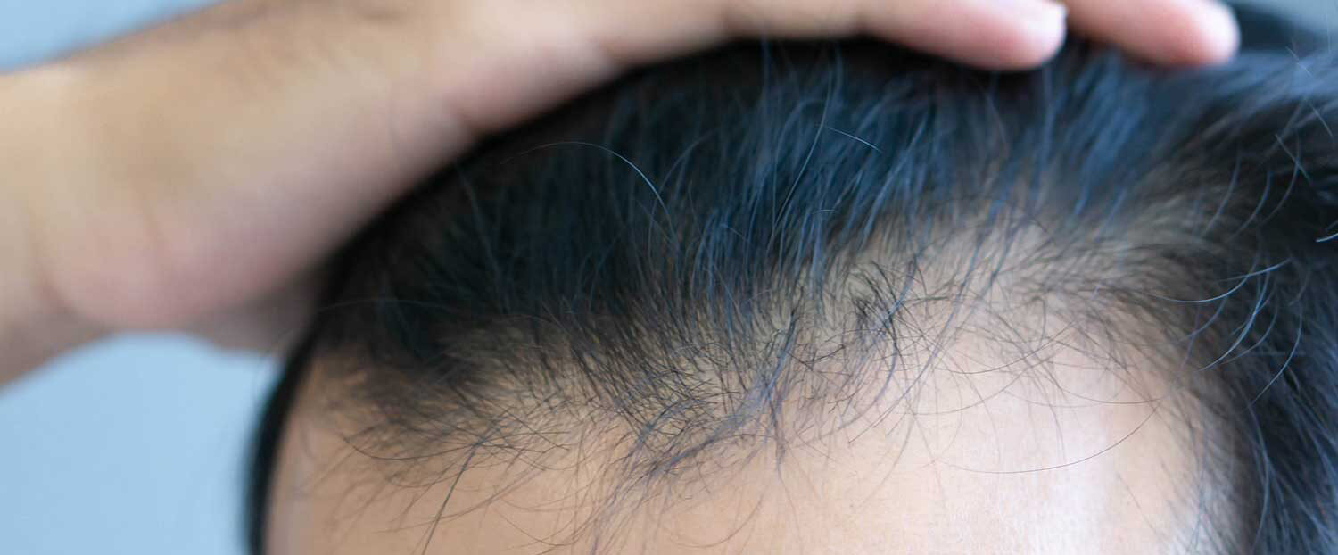 nachher-bild-ohne-rasur-e1689239515668 Blog Header Unshaven